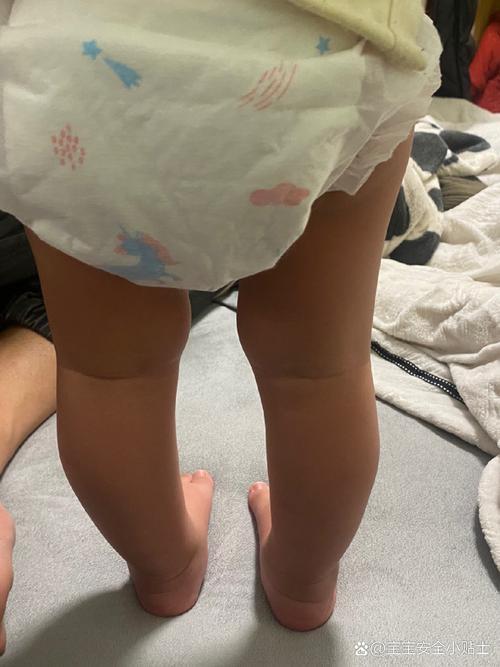 寶貝腿張大點就不疼了